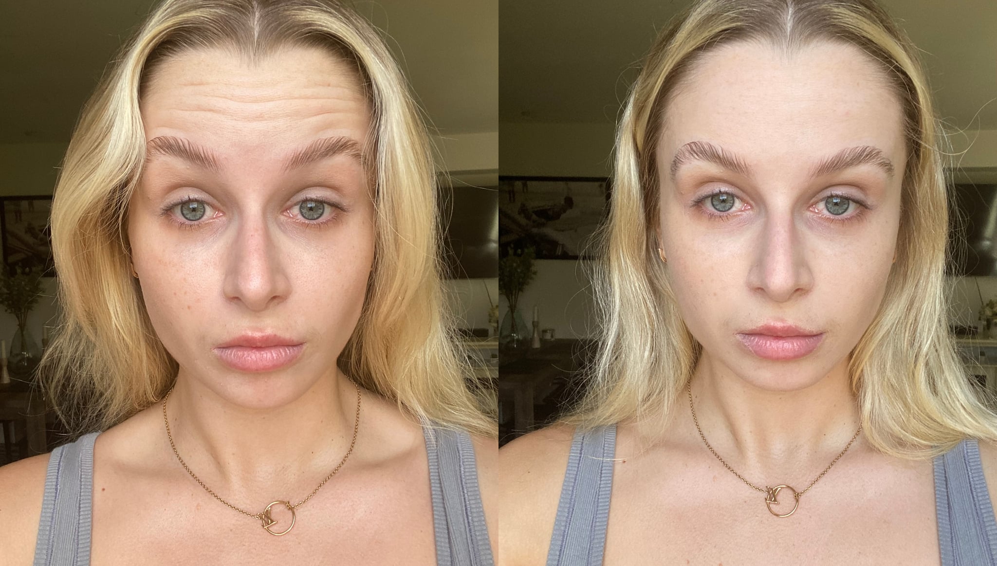 До и после использования средства Nakery Beauty Instant Wrinkle Eraser