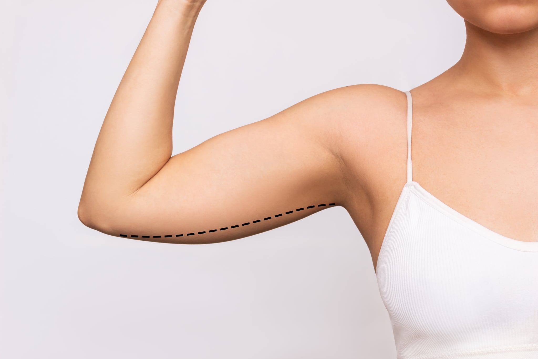 Обрезанный снимок молодой женщины с избыточным жиром на плече со следами липосакции или пластической хирургии, выделенными на сером фоне.  Рыхлые и обвисшие мышцы.  Избыточный вес.  Концепция красоты