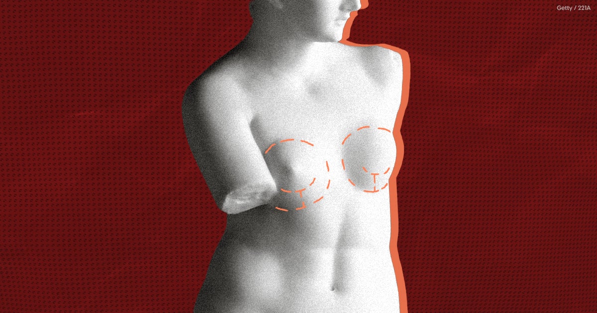 Как пластика груди помогла моему телу
